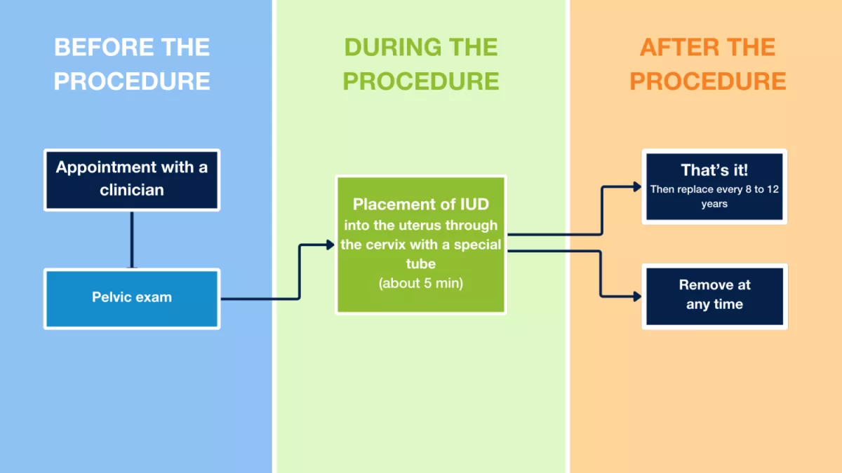 IUD Flowchart:  Before the Procedure:  Doctor's Appointment  Pelvic Exam  During the Procedure:  Placement of the IUD into the uterus through the cervix with a special tube (approximately 5 minutes)  After the Procedure:  That's all for now! Replace it every 8 to 12 years  Remove it at any time.