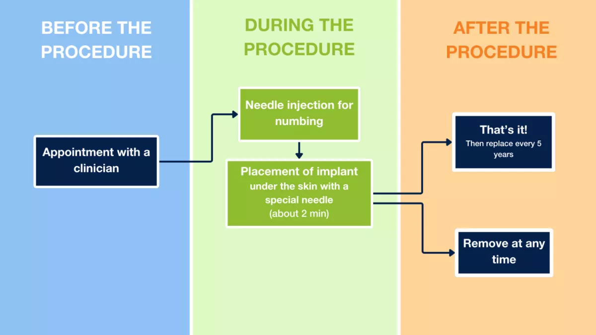 Arm Implant Flowchart:  Before the Procedure:  Doctor's Appointment  During the Procedure:  Anesthetic injection to numb the area Placement of the implant under the skin with a special needle (approximately 2 minutes)  After the Procedure:  That's all for now! Replace it every 5 years.  Remove it at any time.