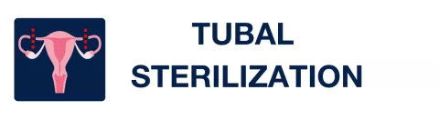 tubal sterilization