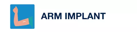 arm implant